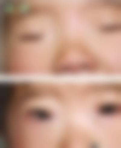 预约优惠活动 原晓玲 天津中 医 药大学第二附属医院眼科