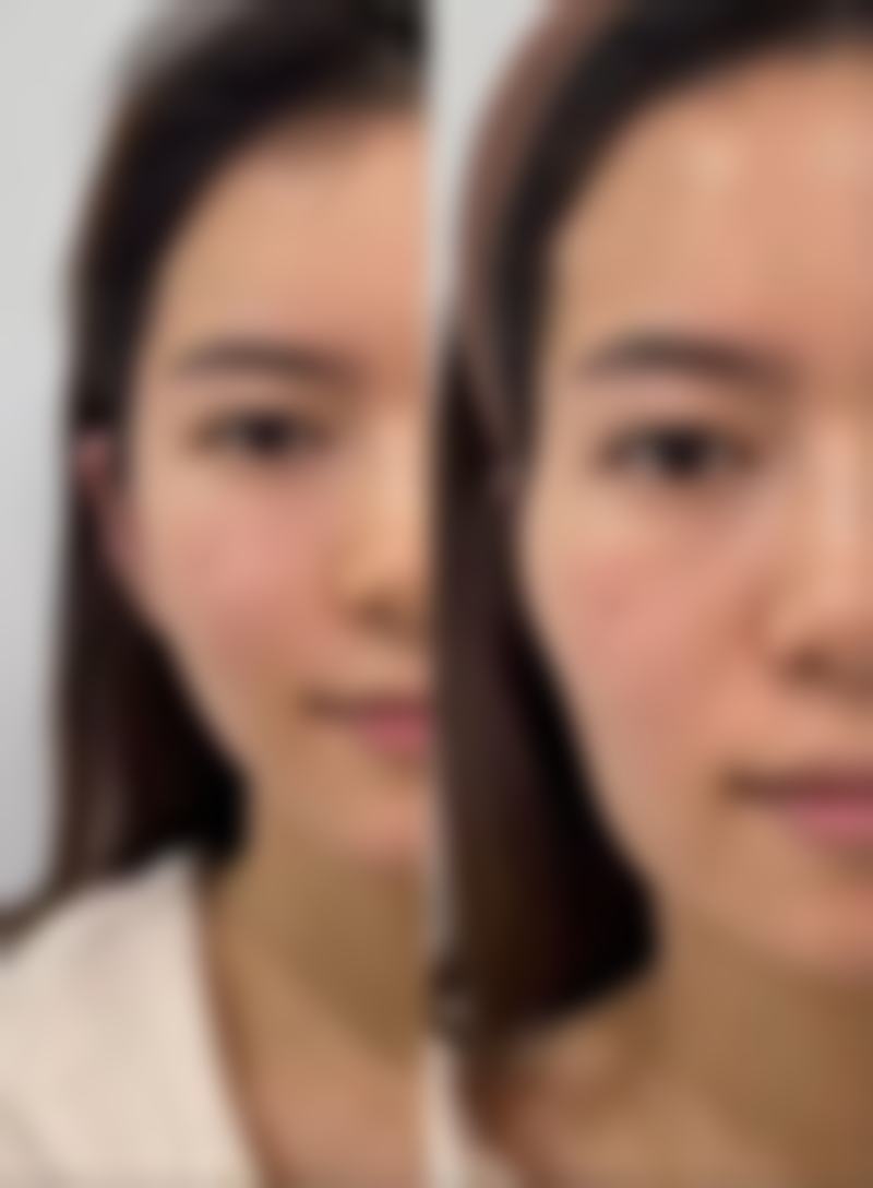 毛彤春医生的技术实力