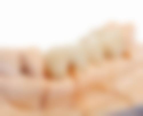 山东日照瑞贝口腔医院治疗反馈与口碑评价。