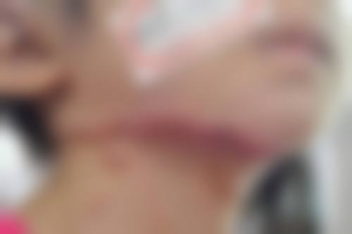 三、松原至美医疗美容诊所开展项目及特色技术