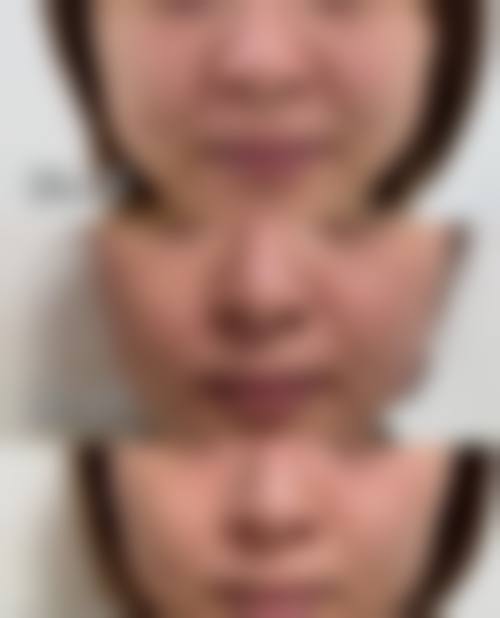 五、关于阳泉煤业集团总医院的常见疑问解答