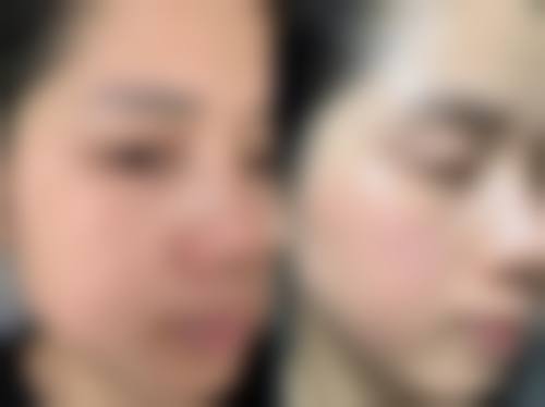 成都真美奇迹整形医疗美容诊所擅长项目。