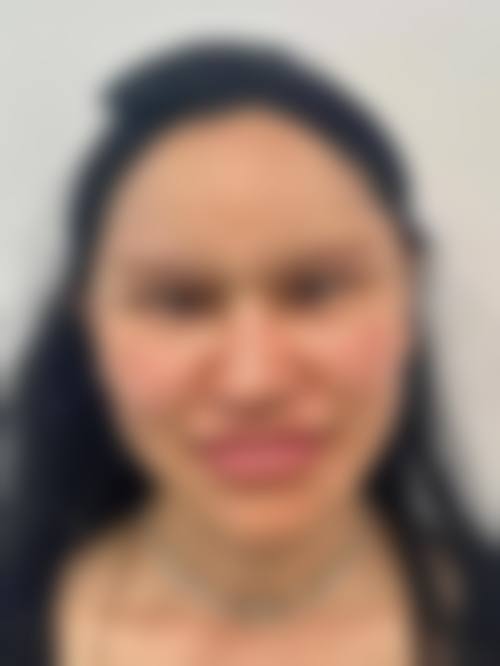 合肥伊微医疗美容门诊部项目优势。