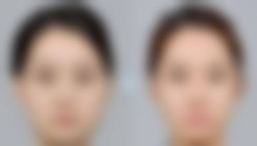 韓國Faceline整形外科醫院怎麼預約掛號 價錢範圍(HKD/MOP)