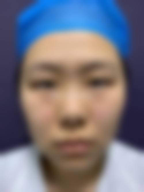 三、王秀伟擅长项目及优势