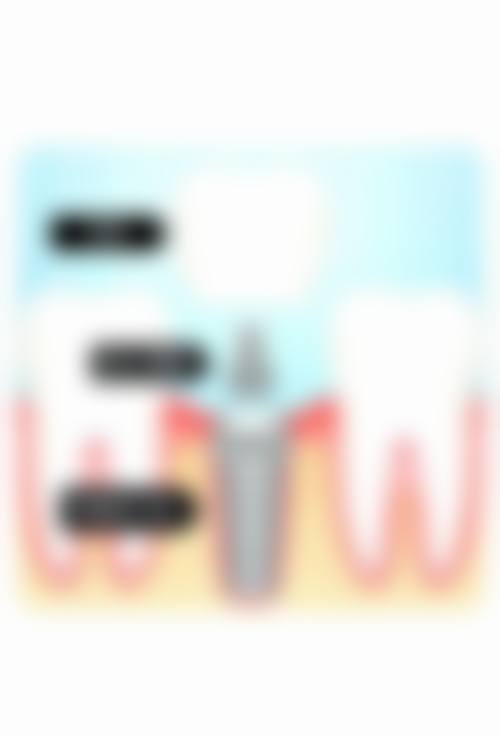 特色项目与数字化矫正优势