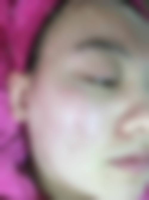 海口叶子妃医疗整形美容医生团队经验稳定。