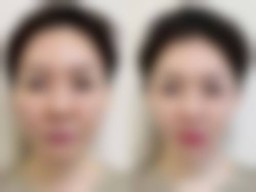 中山希妍整形医院2026年价格收费表: