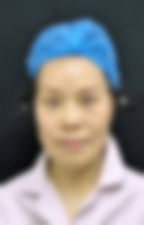 海口叶子妃医疗整形美容治疗反馈与口碑评价。