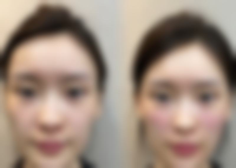 总结与预约号召