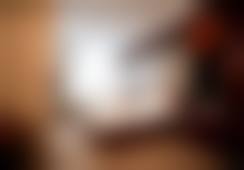 我的热拉提紧致皮肤真实案例：法令纹淡了，脸也紧致了