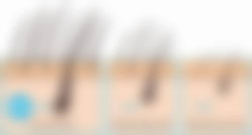 三、韩国三个心愿皮肤科明洞店开展项目及特色技术