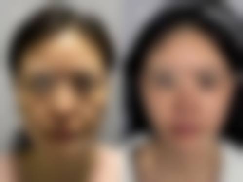 成都莱雅医疗美容诊所预约挂号方式。