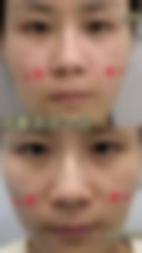 许昌美莱美医疗美容门诊部预约挂号方式。