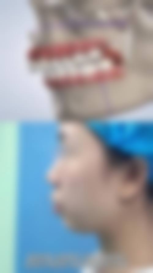 淄博桓台天然口腔治疗反馈与口碑评价。