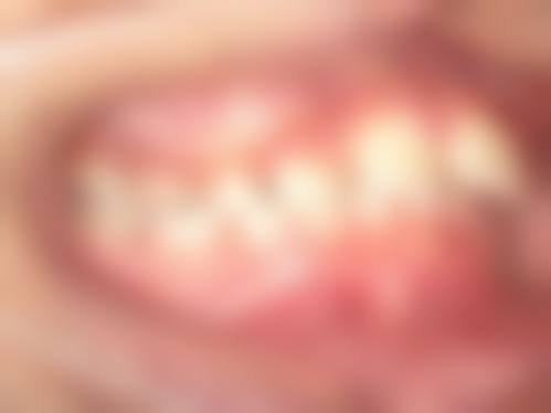患者口碑怎么样?几位在珠海拜博口腔医院找吴晓飞医生看牙的真实反馈