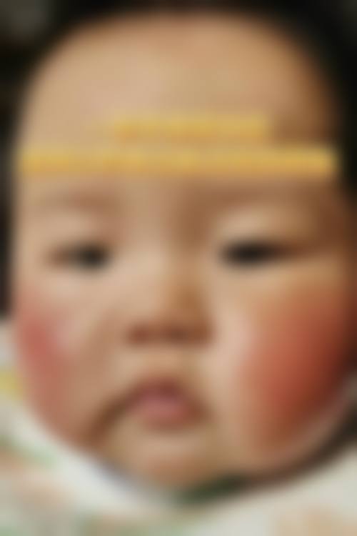 临床实例分享
