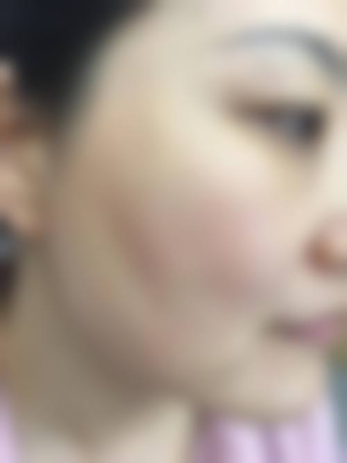 温州百佳东方整形美容科擅长项目。