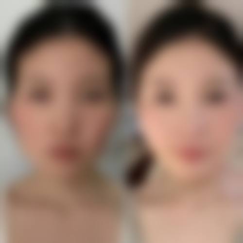 温州百佳东方整形美容科预约挂号方式多样。