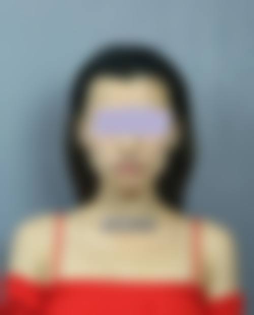 温州百佳东方整形美容科项目优势显著。