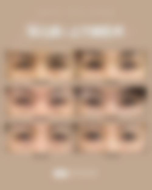 临床实例分享