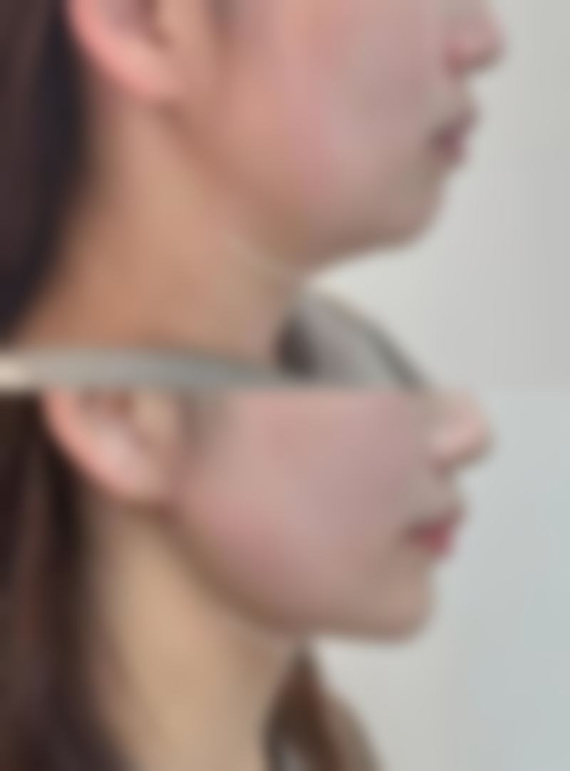 总结与预约号召