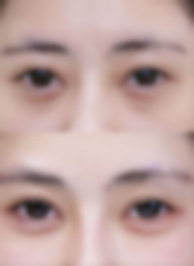 五、伊宁王茜医疗美容整形诊所收费价格表/收费标准