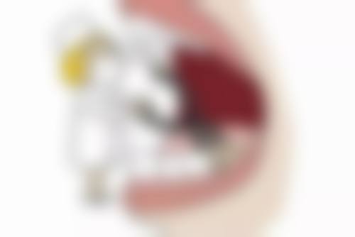 隱形牙套術前術後避坑指南:港澳姊妹實用貼士!