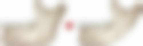 韓國AB整形外科醫院價格表2026中韓報價！雙眼皮/隆鼻含術前評估無隱形消費