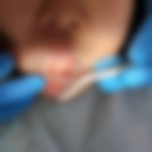 优惠活动详情