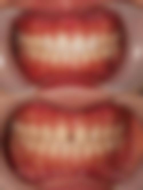广西百色雅洁口腔治疗反馈与口碑评价。