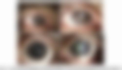 五、来看诊的人怎么说?徐州威沃眼科诊所口碑好评