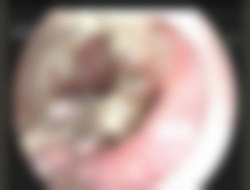 九、韓國ILOVE整形外科口碑好不好?患者診室評價:
