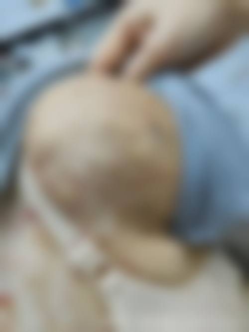 八、患者常见问题解答(精选 )