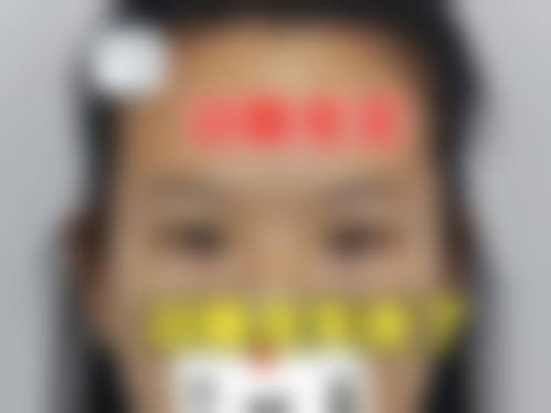 五、东莞健瑞韩美医疗美容门诊部收费价格表/收费标准
