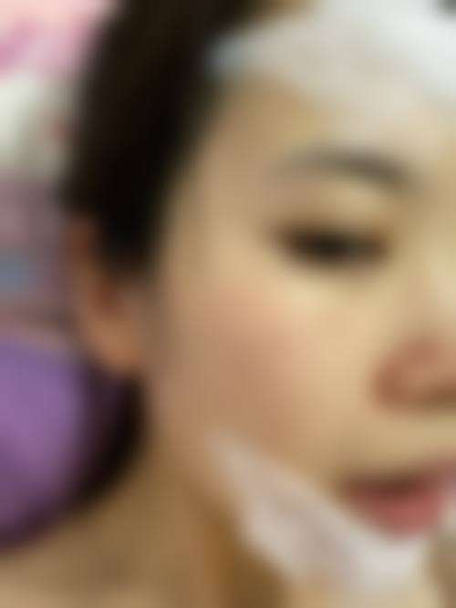 临床实例分享
