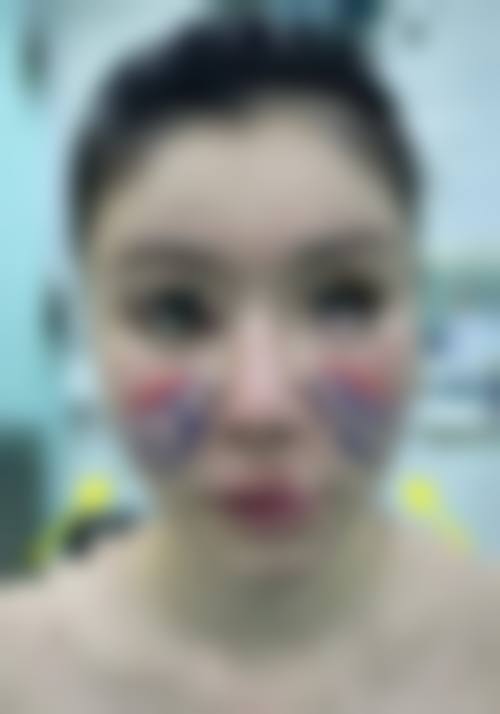 一、东莞健瑞韩美医疗美容门诊部是正规医院吗?