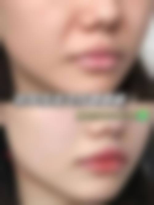 预约优惠活动