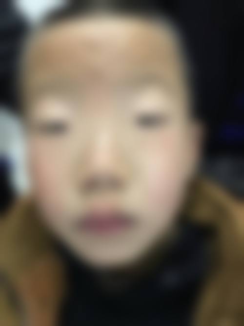 广州小亮点眼科诊所擅长项目。