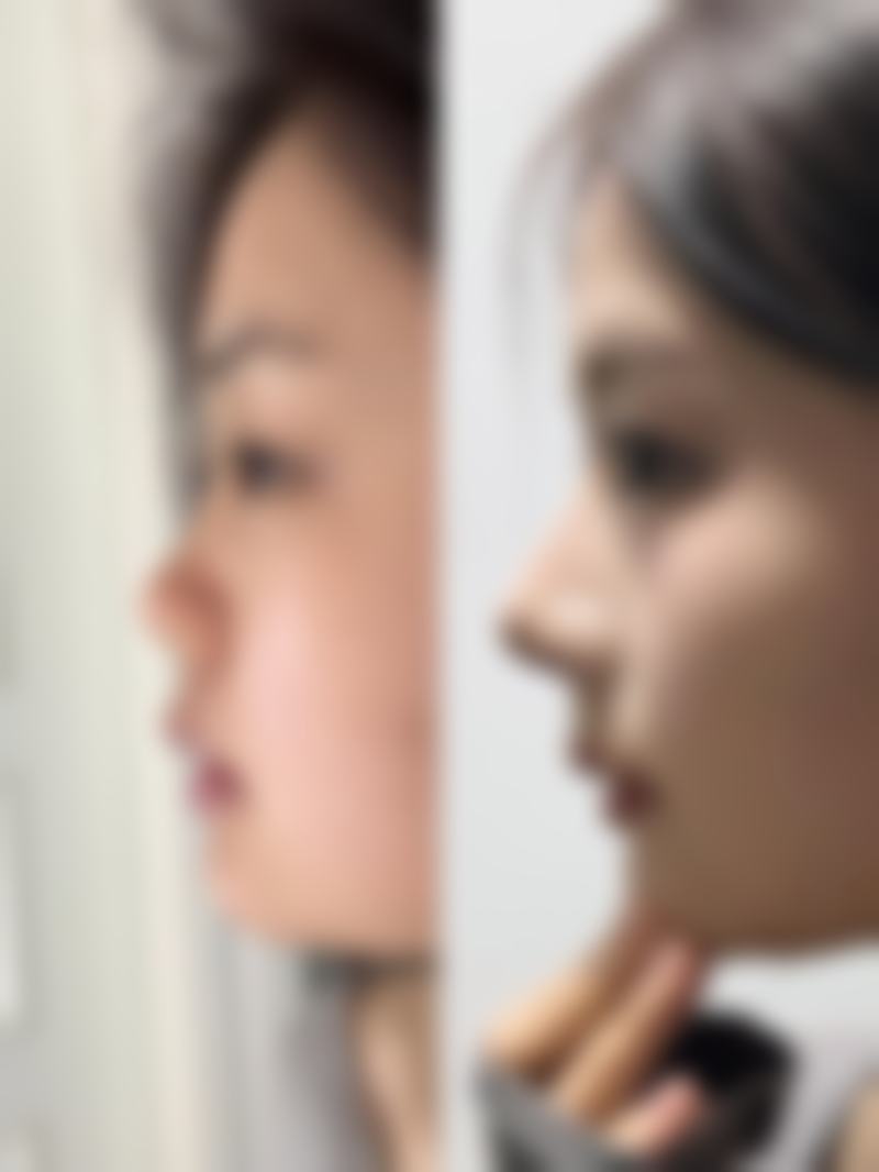 三、韓國ILOVE整形外科開展項目及特色技術