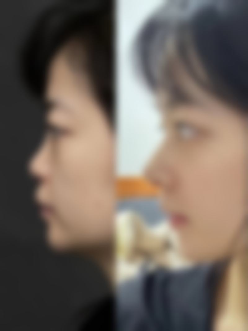 大同圣林医疗美容诊所的擅长项目——全方面覆盖你的美丽诉求