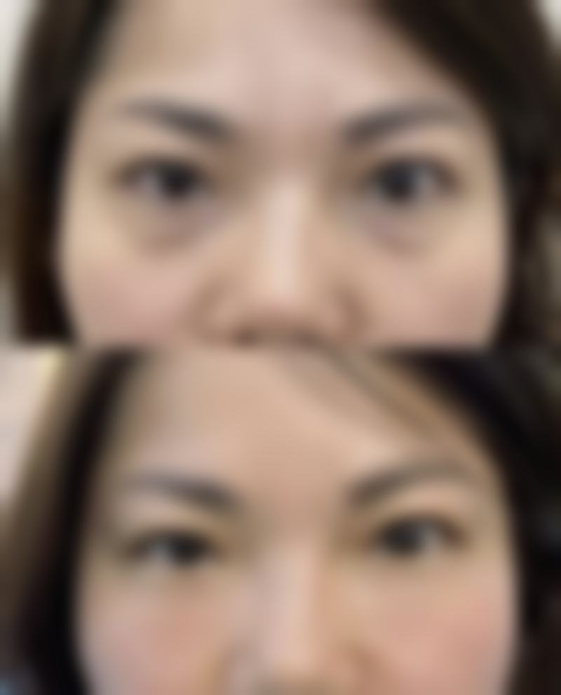 绵阳漾轻心医疗美容诊所擅长项目。