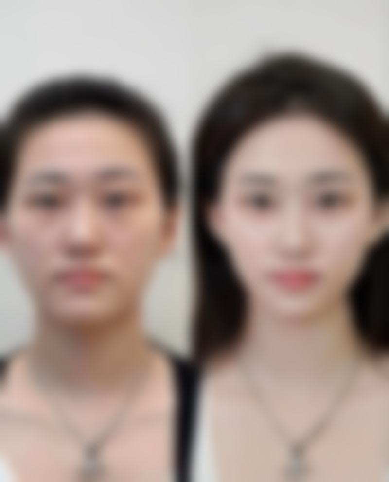 大同圣林医疗美容诊所怎么样？正规资质与专精实力深度解析