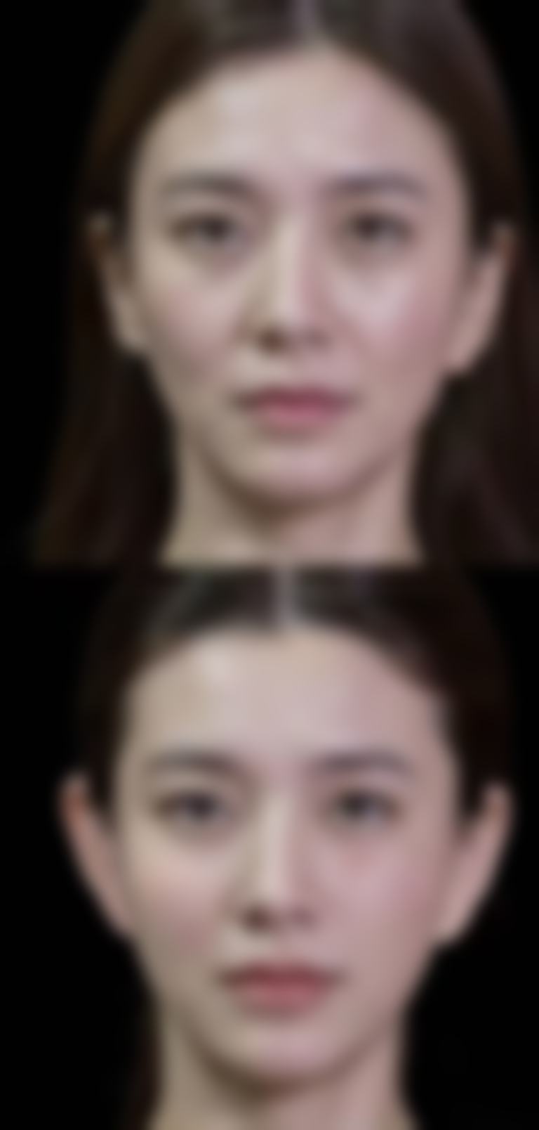 合肥博肤整形医院的医生团队怎么样?服务贴心吗?