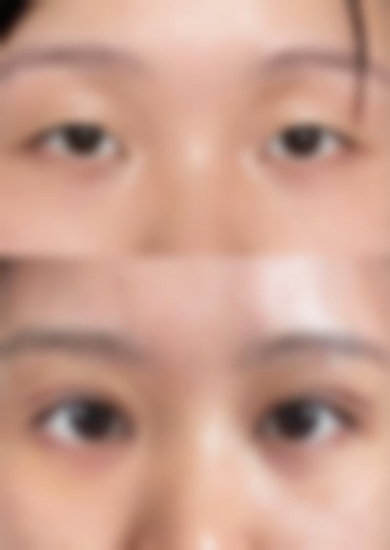 临床实例分享